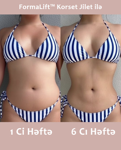 FormaLift™ - Korset Jilet